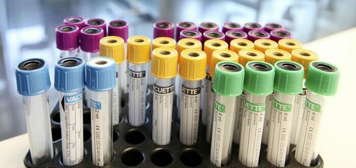 Laboratory colored viles